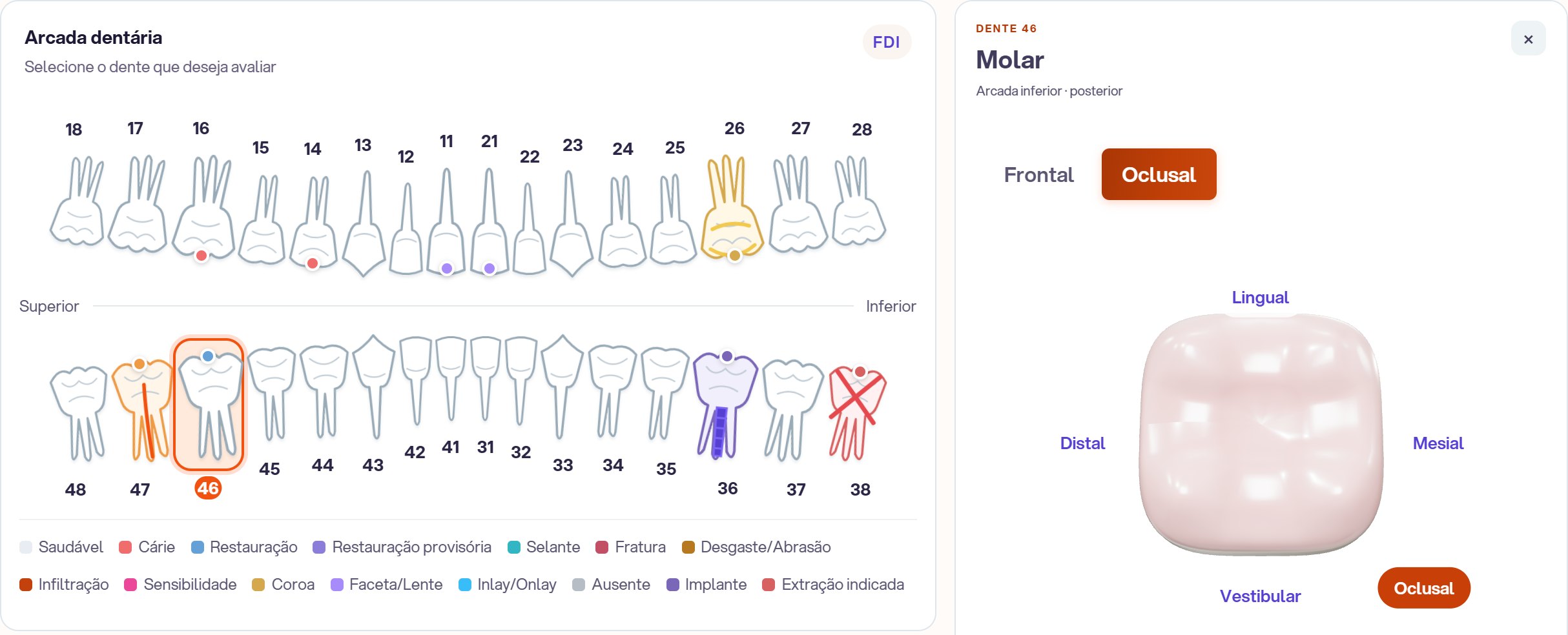 Odontograma do OdontoConex com a arcada em desenho e o painel do dente selecionado